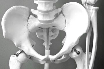 Shockwave Therapy For Hip Pain